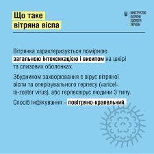 Вітряна віспа